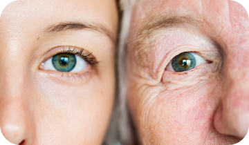 Close-up comparison of young and mature eyes